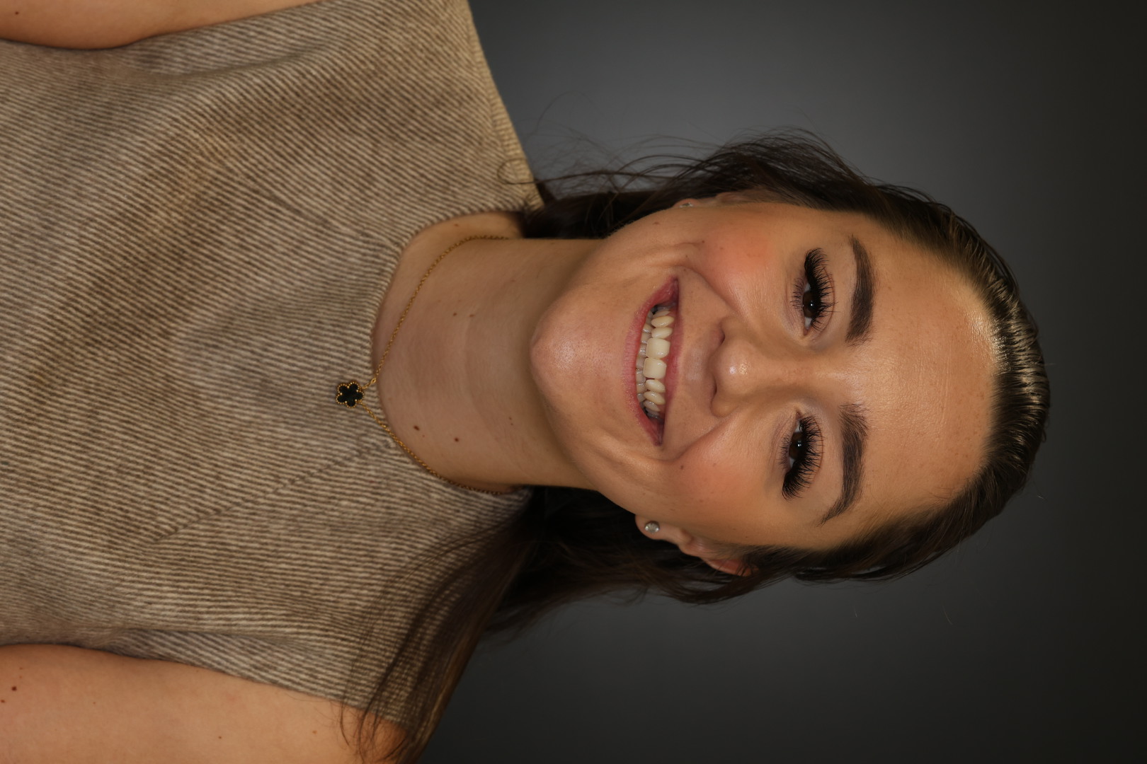 Case 04, before, smiling portrait