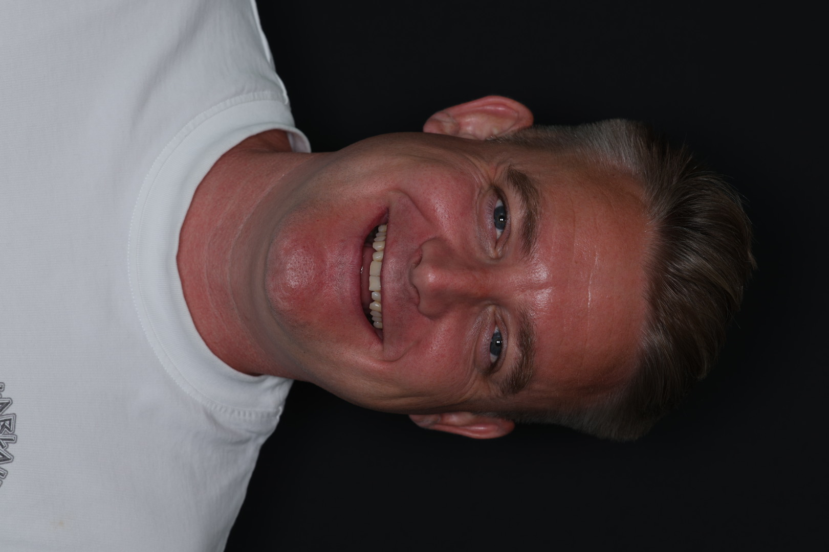 Case 02, before, smiling portrait