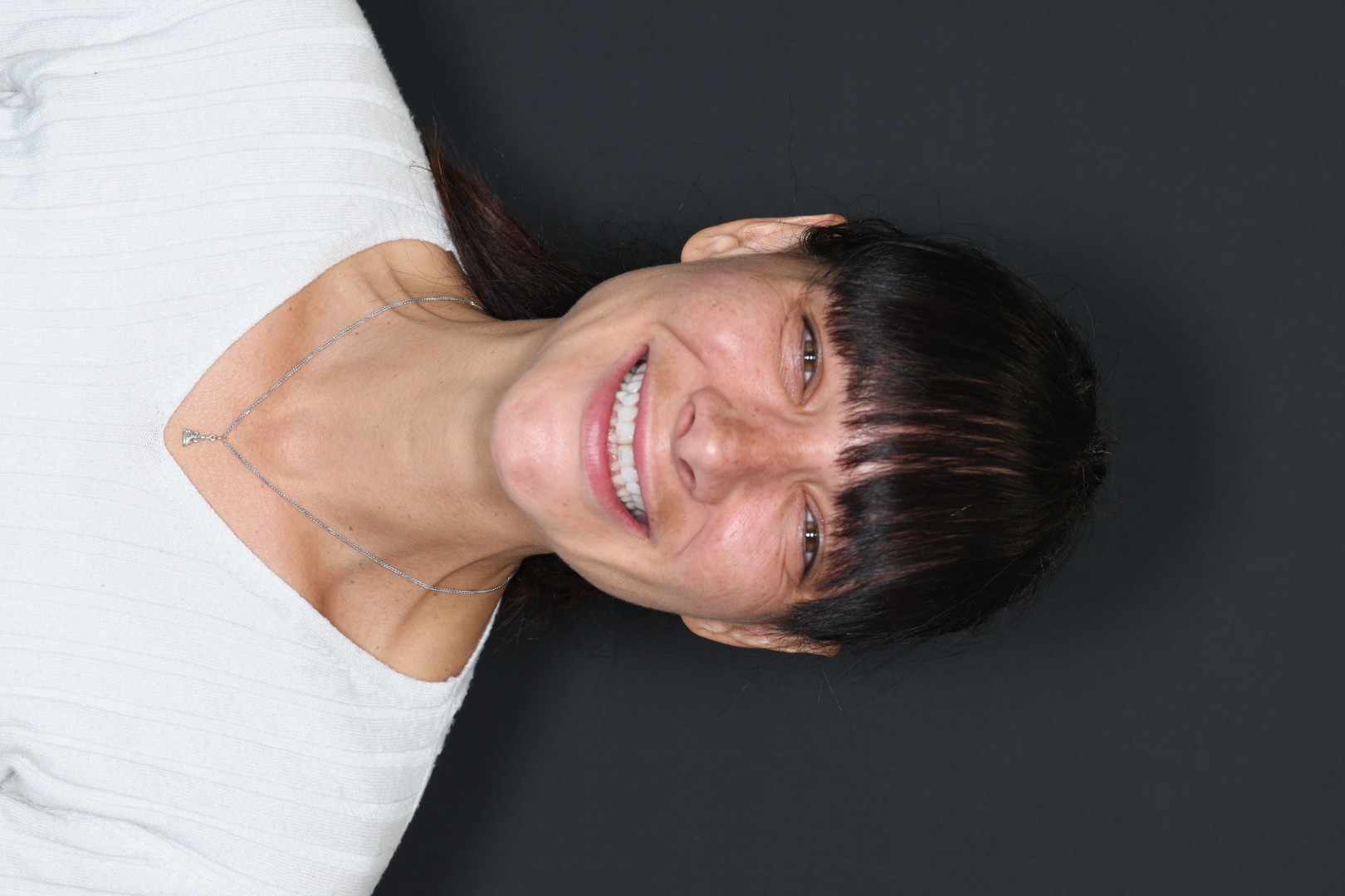 Case 01, before, smiling portrait
